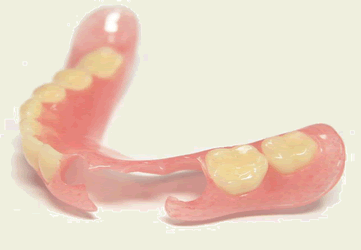 ノンクラスプデンチャーの画像